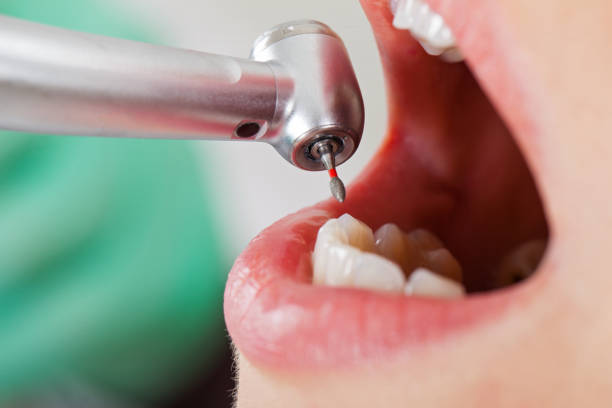 Best Emergency Dentist for Knocked-Out Tooth in Town Creek, AL
